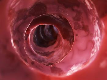 Crohn Hastalığı ve Bağırsak Virüsleri Arasındaki Bağlantı
